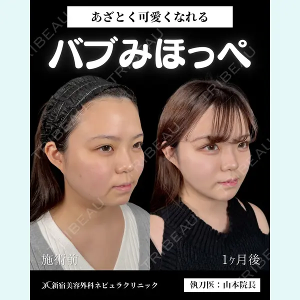 新宿美容外科ネビュラクリニック 山本 紘子医師の症例