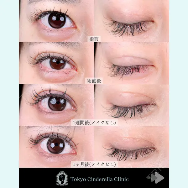 東京シンデレラ美容外科 池袋院 石井 達也医師の症例