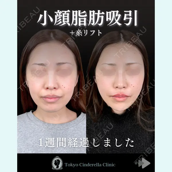 東京シンデレラ美容外科 池袋院 石井 達也医師の症例