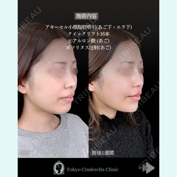 東京シンデレラ美容外科 池袋院 石井 達也医師の症例