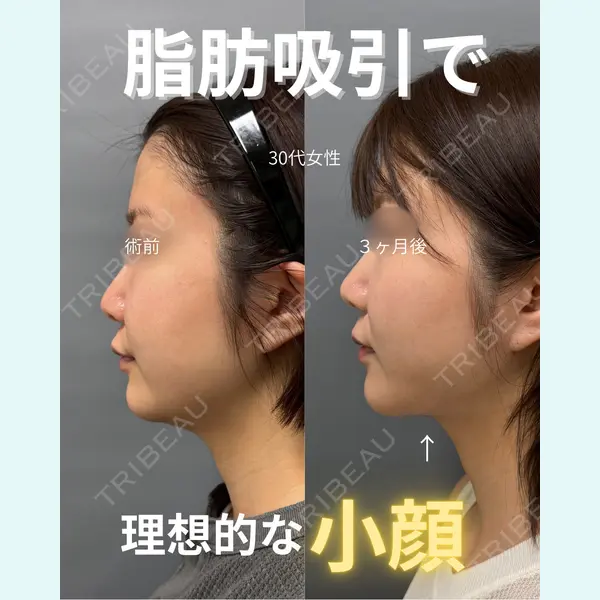 春山記念病院 山田 浩之医師の症例