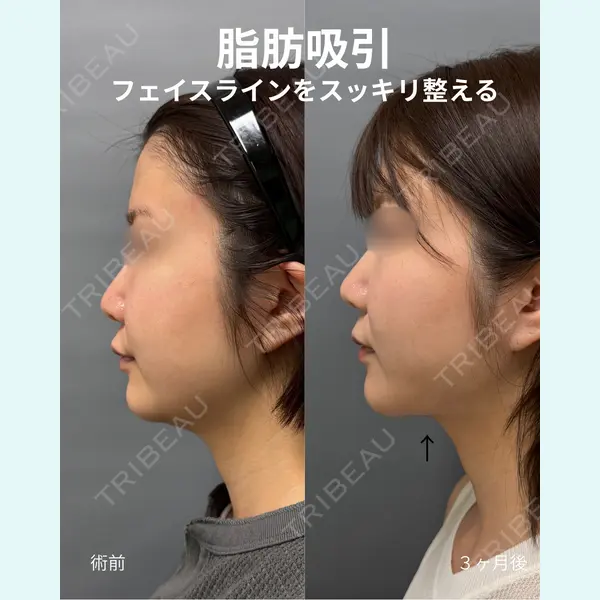 春山記念病院 山田 浩之医師の症例