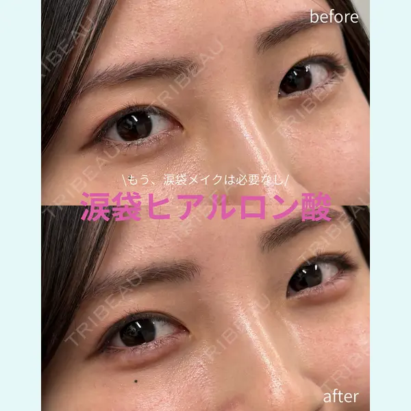 春山記念病院 山田 浩之医師の症例