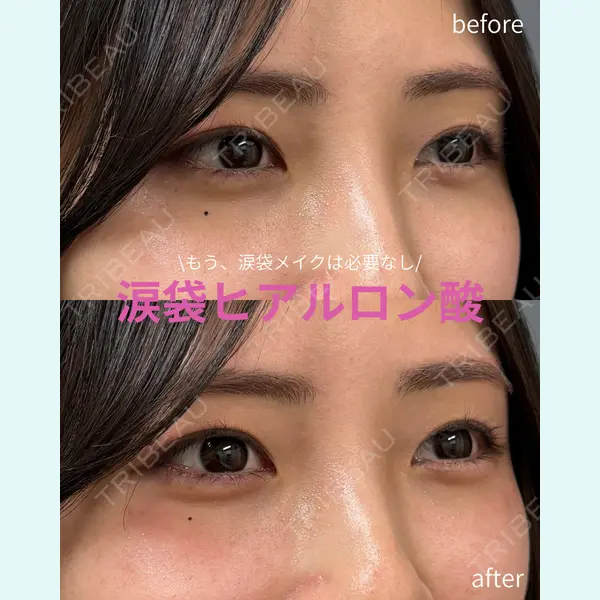 春山記念病院 山田 浩之医師の症例