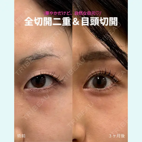 春山記念病院 山田 浩之医師の症例