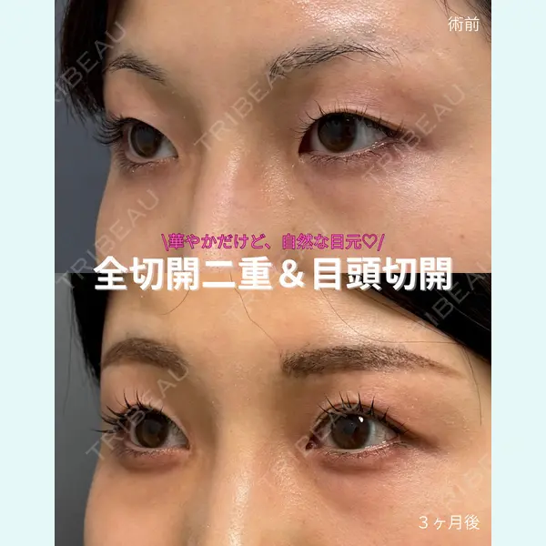 春山記念病院 山田 浩之医師の症例