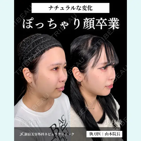 新宿美容外科ネビュラクリニック 山本 紘子医師の症例