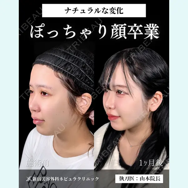 新宿美容外科ネビュラクリニック 山本 紘子医師の症例