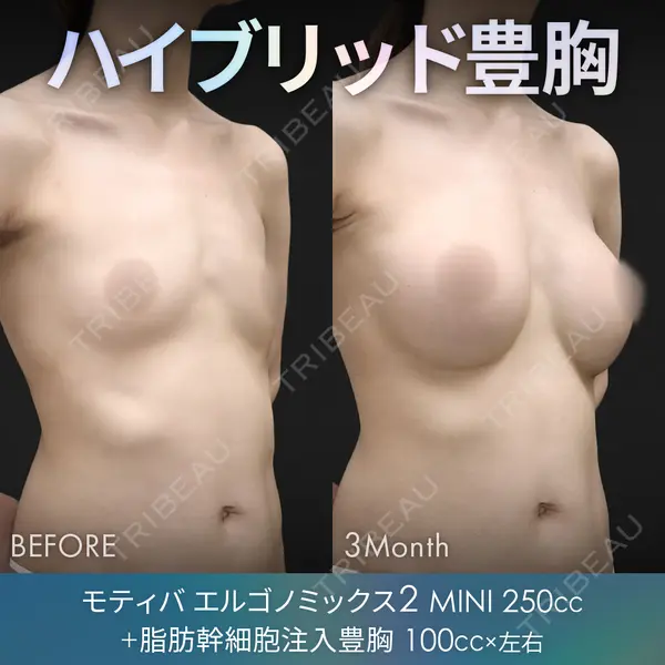 ジョウクリニック 銀座院 重本　譲医師の症例