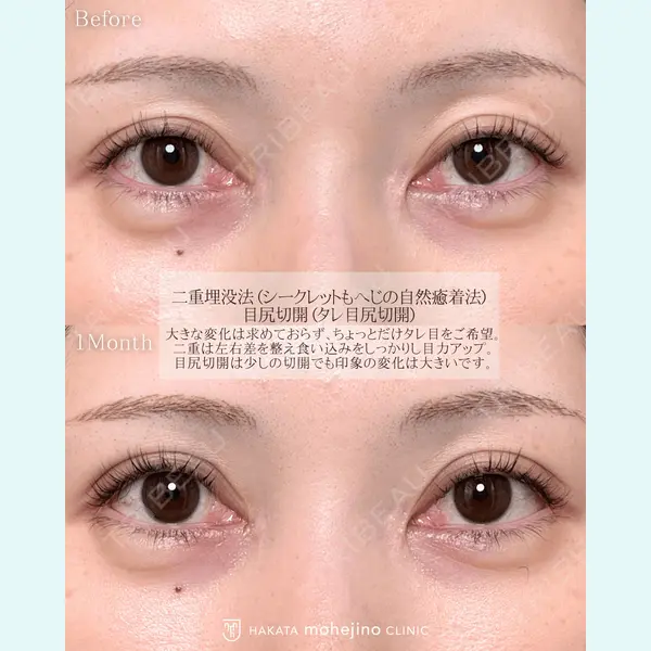 博多もへじのクリニック 村田 将光医師の症例