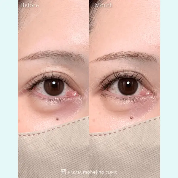 博多もへじのクリニック 村田 将光医師の症例