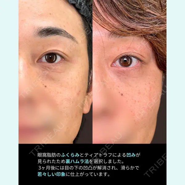 eクリニック 岡山院 田嶋 隼也医師の症例