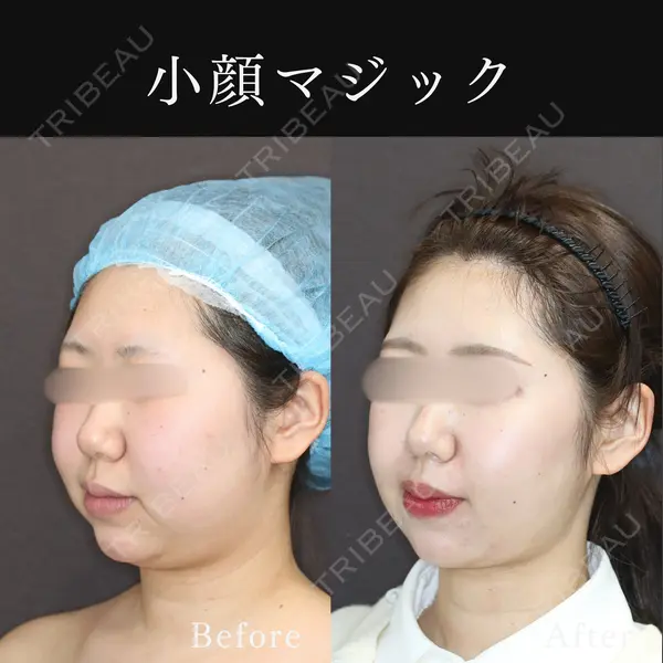 東京ココセランクリニック 篠﨑 智公医師の症例