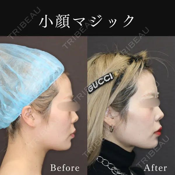 東京ココセランクリニック 篠﨑 智公医師の症例