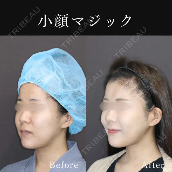 東京ココセランクリニック 篠﨑 智公医師の症例