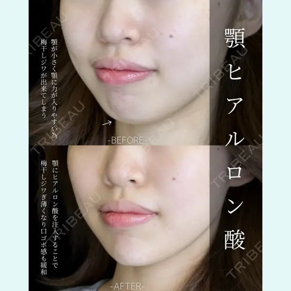 ルラ美容クリニック 大宮院 / ルラスキンクリニック 大宮院 右京 大季医師の症例