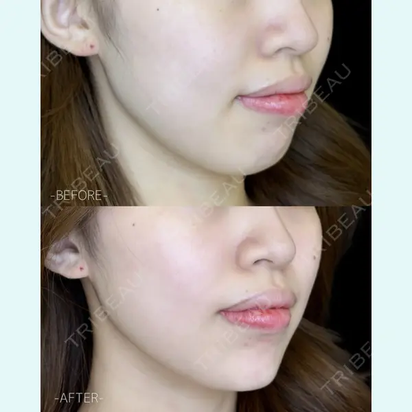 ルラ美容クリニック 大宮院 / ルラスキンクリニック 大宮院 右京 大季医師の症例