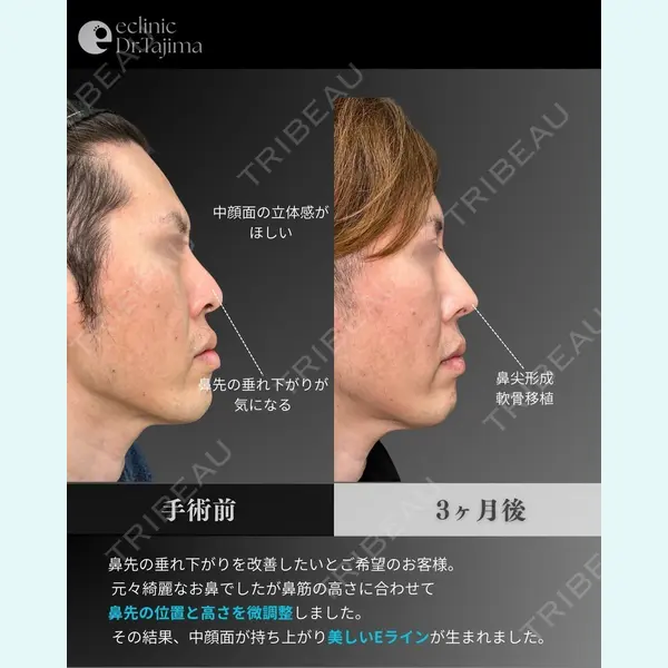 eクリニック 岡山院 田嶋 隼也医師の症例