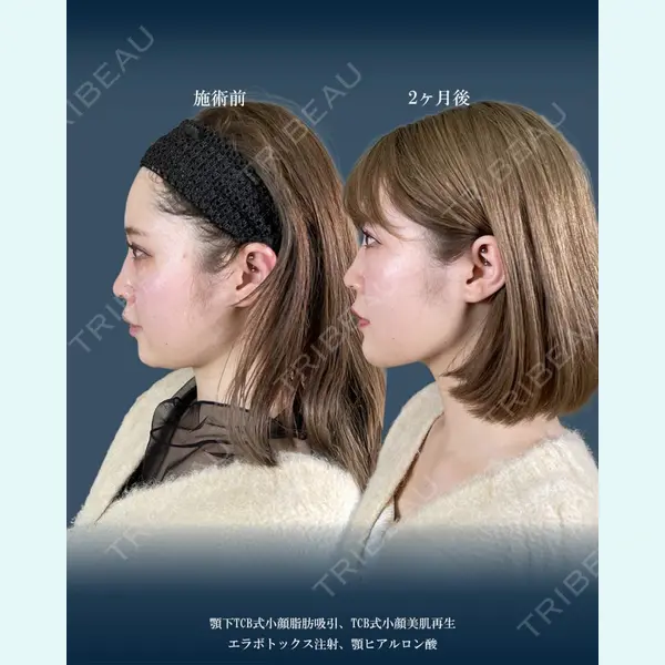 TCB東京中央美容外科 横浜駅前院 大見 貴秀医師の症例