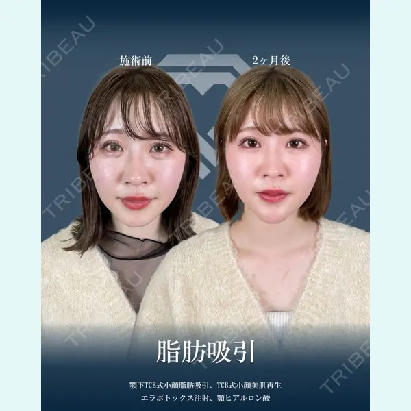 TCB東京中央美容外科 横浜駅前院 大見 貴秀医師の症例