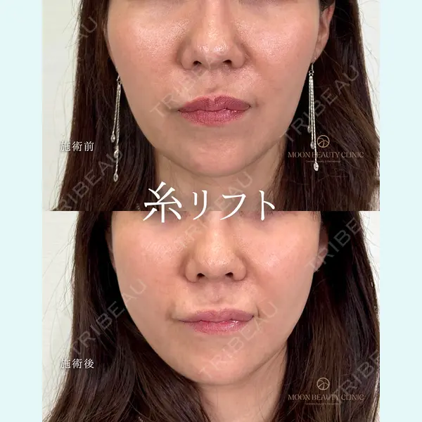 Moon Beauty Clinic 渡邉 正士医師の症例