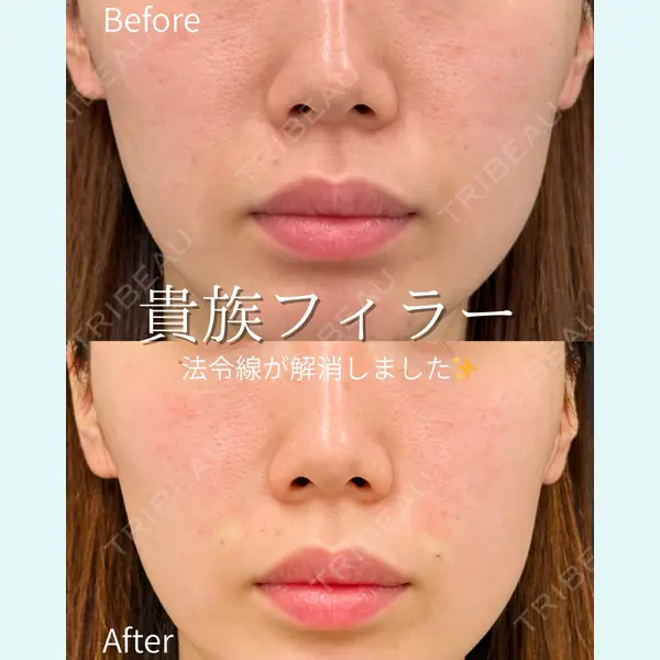 ルラ美容クリニック 仙台院 / ルラスキンクリニック 仙台院 橋本 英樹医師の症例