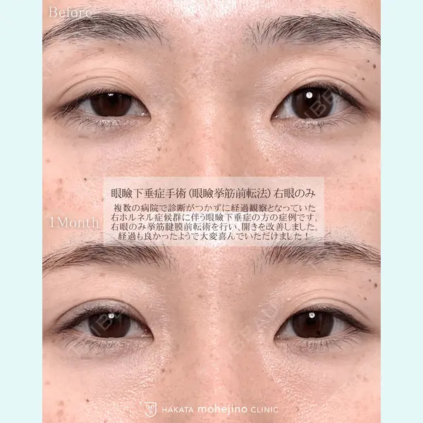 博多もへじのクリニック 村田 将光医師の症例