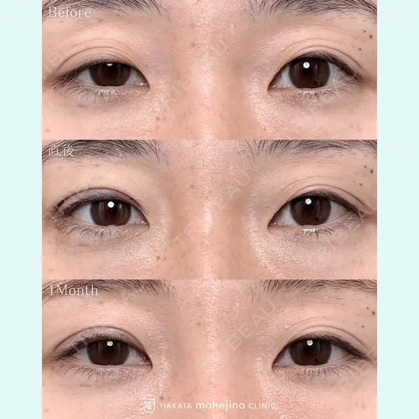 博多もへじのクリニック 村田 将光医師の症例