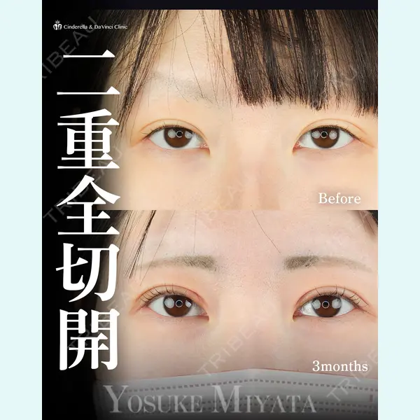 シンデレラ＆ダヴィンチクリニック 宮田 洋佑医師の症例