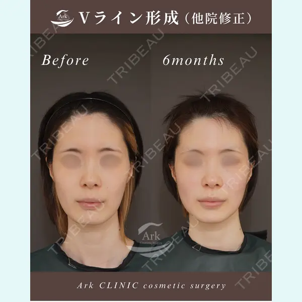 アーククリニック 加藤 雄大医師の症例