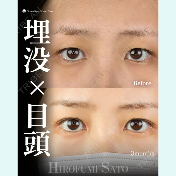 シンデレラ＆ダヴィンチクリニック 佐藤 博文医師の症例