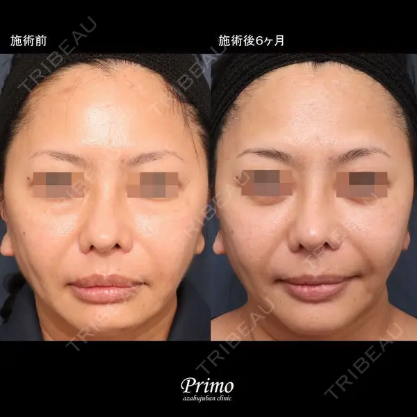 プリモ麻布十番クリニック 大場教弘医師の症例