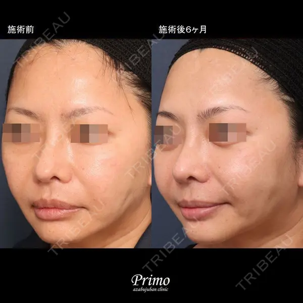 プリモ麻布十番クリニック 大場教弘医師の症例