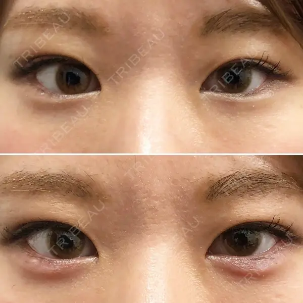 しのぶ皮膚科 蘇原しのぶ医師の症例