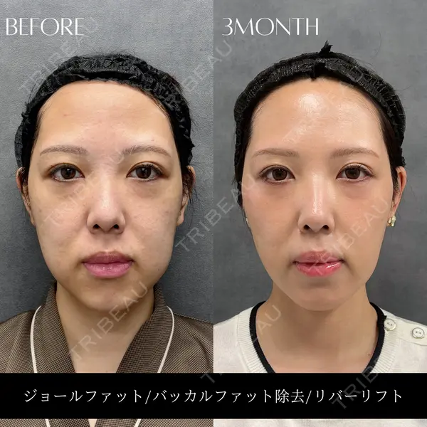 RIVER CLINIC（リバークリニック）大阪院 木家 佑理子医師の症例