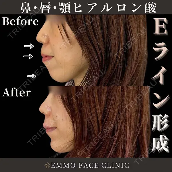 EMMO FACE CLINIC 東京三田院 木之下 哲彦医師の症例