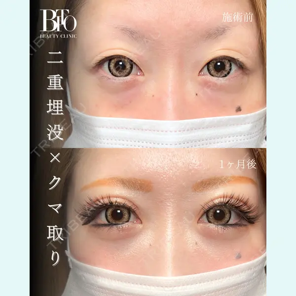 BITO BEAUTY CLINIC 伊藤 富良野医師の症例