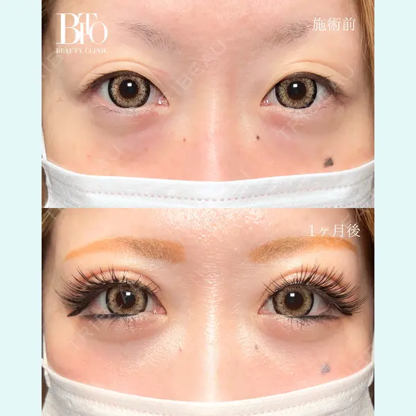 BITO BEAUTY CLINIC 伊藤 富良野医師の症例