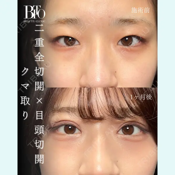 BITO BEAUTY CLINIC 伊藤 富良野医師の症例