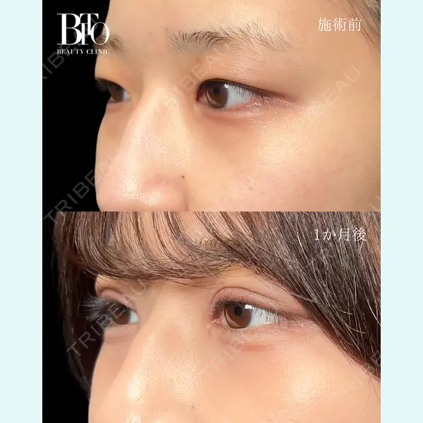 BITO BEAUTY CLINIC 伊藤 富良野医師の症例