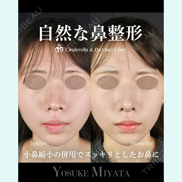 シンデレラ＆ダヴィンチクリニック 宮田 洋佑医師の症例