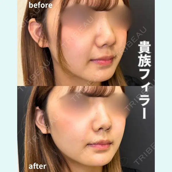 ルラ美容クリニック 名古屋栄院 / ルラスキンクリニック 名古屋栄院 牧野 裕大医師の症例