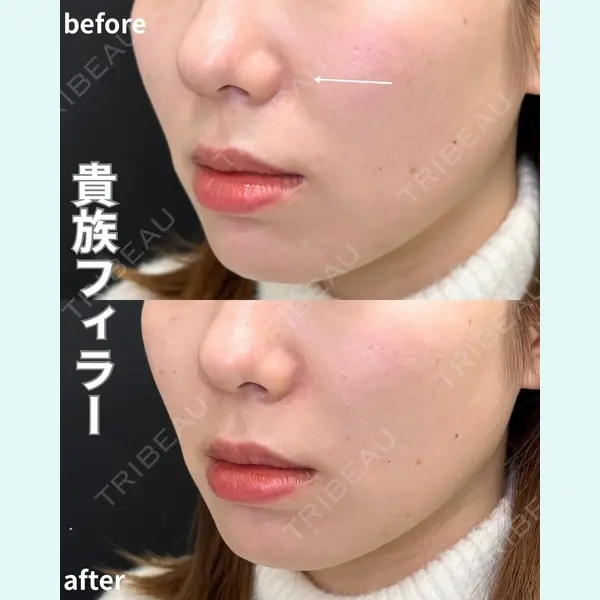 ルラ美容クリニック 名古屋栄院 / ルラスキンクリニック 名古屋栄院 牧野 裕大医師の症例