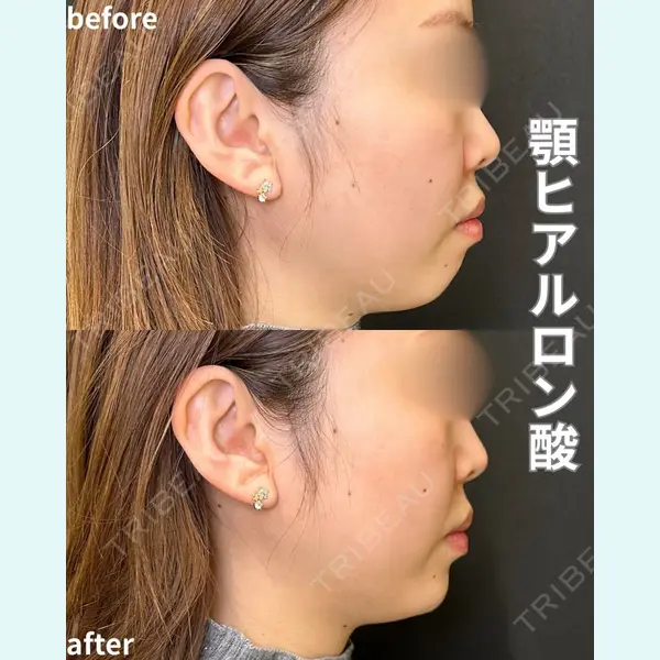 ルラ美容クリニック 名古屋栄院 / ルラスキンクリニック 名古屋栄院 牧野 裕大医師の症例