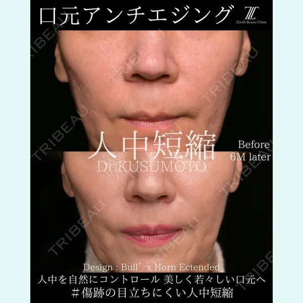 Zetith Beauty Clinic 銀座院 楠本 拓哉医師の症例