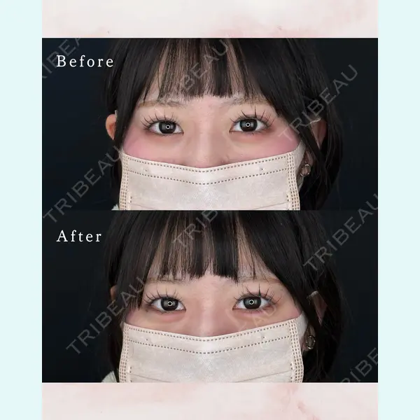 ルラ美容クリニック 東京駅前院 山本 泰輔医師の症例