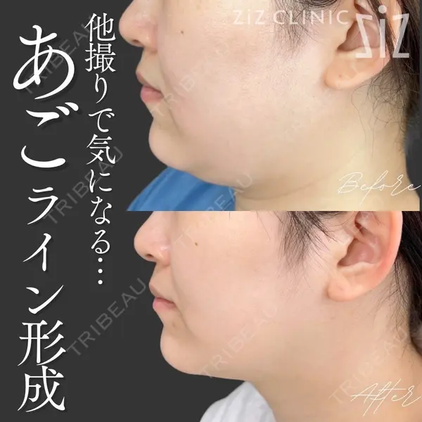 ziz CLINIC 村岡 史子医師の症例