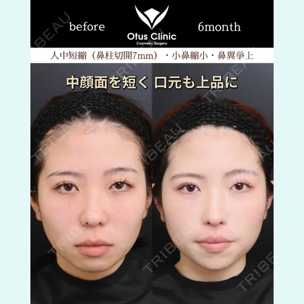 Otus Clinic 【オータスクリニック】 中 徳太郎医師の症例