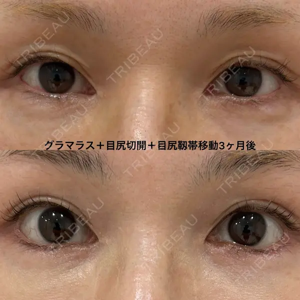 エターナル美容クリニック 久門田 詳医師の症例