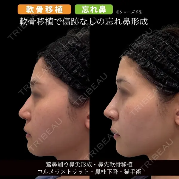 東京美専クリニック 土田 諒平医師の症例